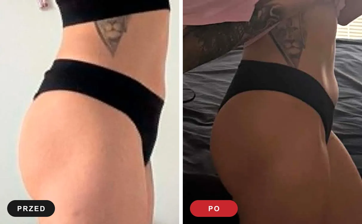 Pośladki i uda podopiecznej Marcina Kujawy przed i po treningach, widok z boku